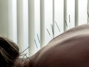 acupuncture for creative professionals